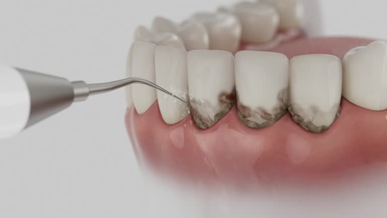 Trusted Teeth Cleaning And Checkup service in Orange Beach, AL - Dentist Open Now